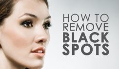 How To Remove Dark Spots