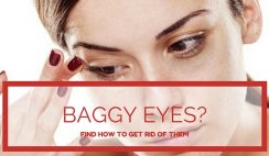 How To Get Rid Of Baggy Eyes
