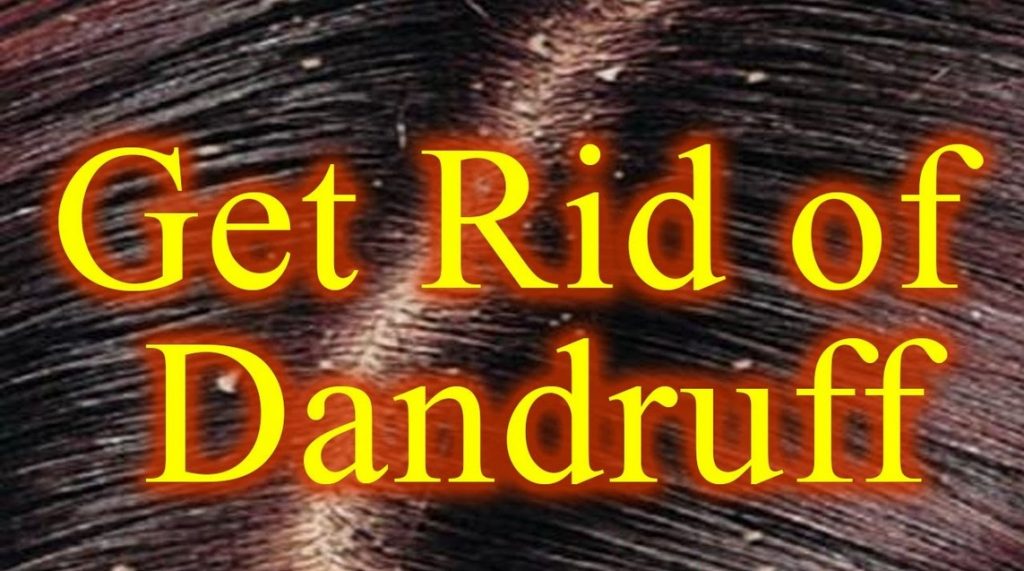 10 Home Remedies To Get Rid Of Dandruff
