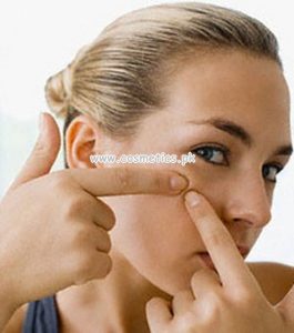 What Causes Of Having Pimples 001