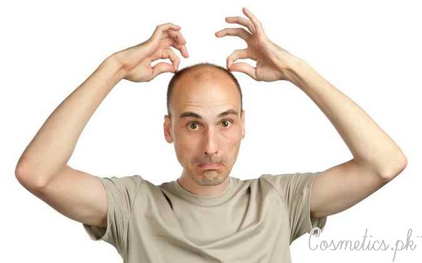 Top 5 Home Remedies For Baldness