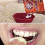 How To Make Your Teeth White