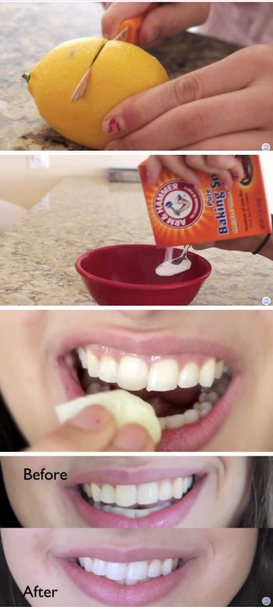 How To Make Your Teeth White