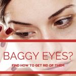 How To Get Rid Of Baggy Eyes