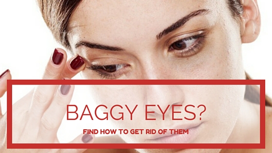 How To Get Rid Of Baggy Eyes