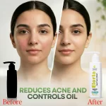 Eloria Acne Prone | Glow Gel Face Wash | 120ml - Image 7